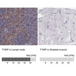 PD-ECGF/Thymidine Phosphorylase Antibody, Novus Biologicals 25ul | Buy Online | Novus Biologicals | Fisher Scientific